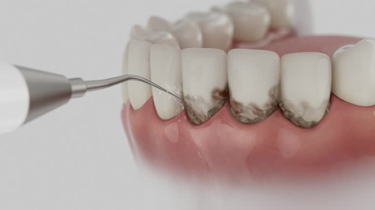 Trusted Emergency Dentist service in Gainesville, GA - Dentist Open Now